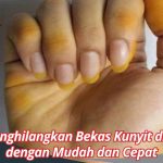 Cara Menghilangkan Noda Kunyit Di Tangan Dengan Cepat Panduan Lengkap Untuk Dapur Bebas Noda