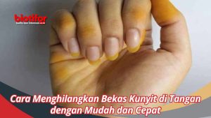 Cara Menghilangkan Noda Kunyit Di Tangan Dengan Cepat Panduan Lengkap Untuk Dapur Bebas Noda