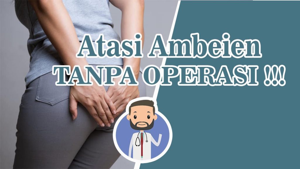 Cara Mengobati Ambeien Tanpa Operasi Panduan Lengkap Untuk Penanganan Efektif