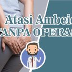 Cara Mengobati Ambeien Tanpa Operasi Panduan Lengkap Untuk Penanganan Efektif