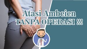 Cara Mengobati Ambeien Tanpa Operasi Panduan Lengkap Untuk Penanganan Efektif